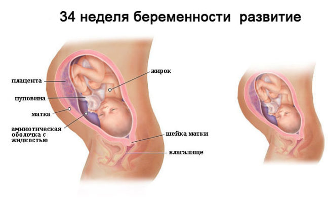 Внутриутробное развитие ребенка 34 неделя беременности