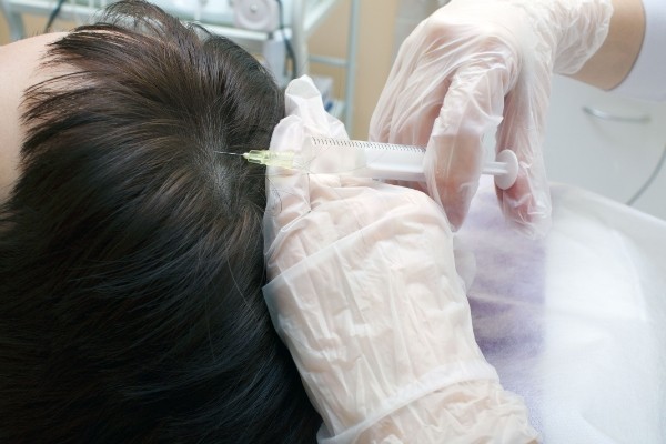 как проводится процедура мезотерапии для волос в домашних условиях