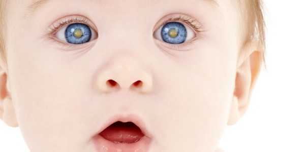 Младенец с катарактой 