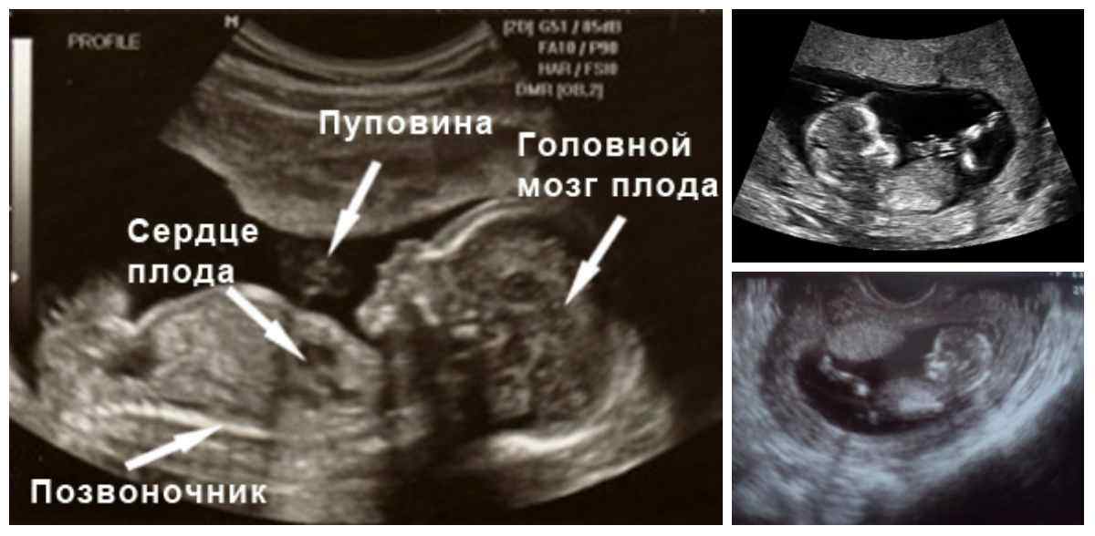 Размер ребенка на 12 неделе беременности фото