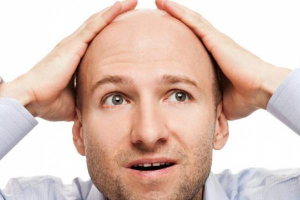 выпадение волос у мужчин в молодом возрасте и его особенности