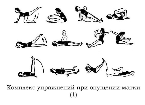 Упражнения Кегеля для женщин в домашних условиях при опущении матки: видео, инструкция