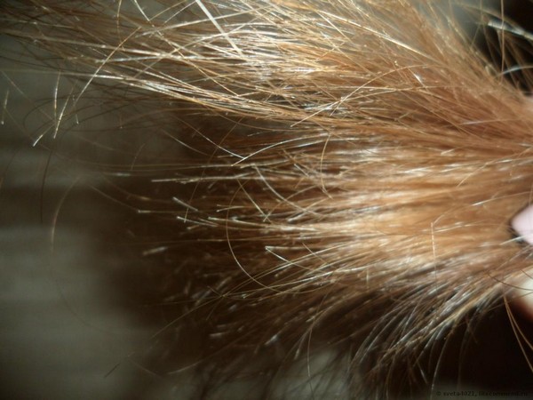 Поврежденные волосы у женщин