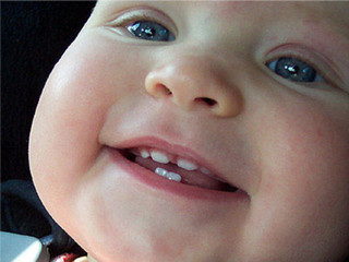 9 месячный ребенок режутся верхние зубы
