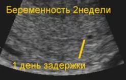 С какого срока можно определить наличие беременности с помощью УЗИ