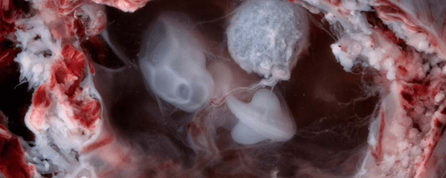 эмбрион на 7 неделе беременности