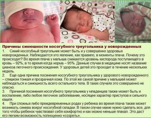 Причины цианоза у новорожденных
