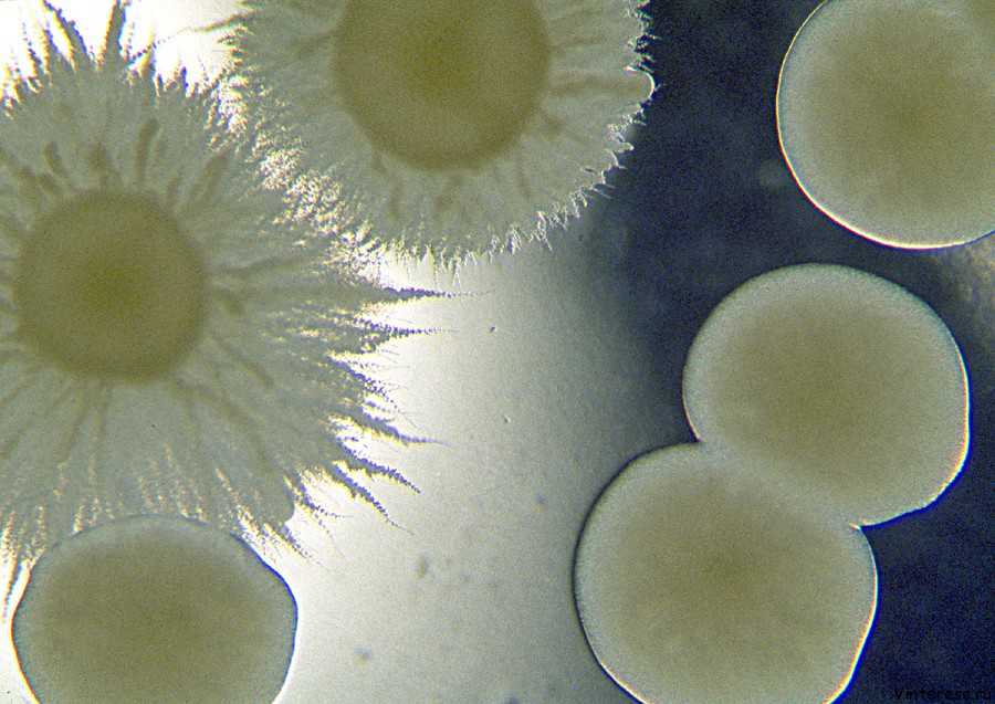 Что такое грибковый кератит: причины возникновения и профилактика
