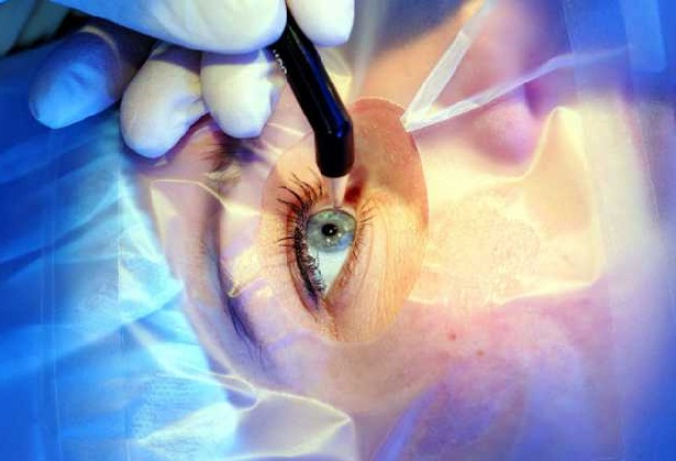 Повреждение глаза во время проведения операции