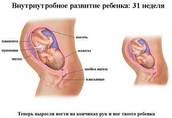 Внутриутробное развитие ребенка 31 неделя