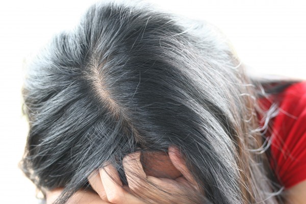почему выпадают волосы после родов