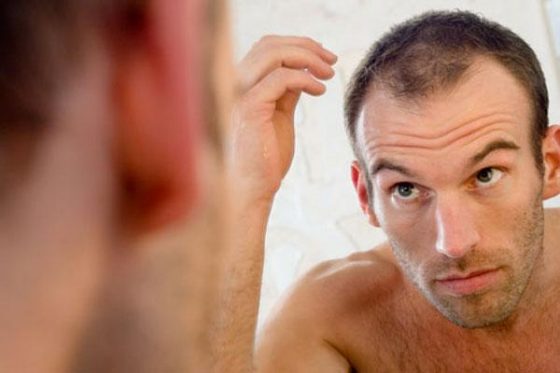 почему происходит выпадение волос у молодых мужчин