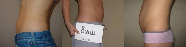живот на 8 неделе беременности