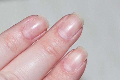 Ногти после снятия гель-лака