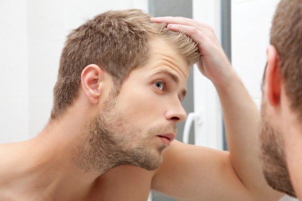 почему выпадают волосы у мужчин
