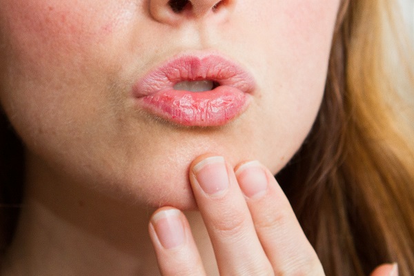 Сухие губы у женщины