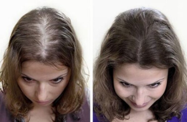 Сравнение волос до и после маски